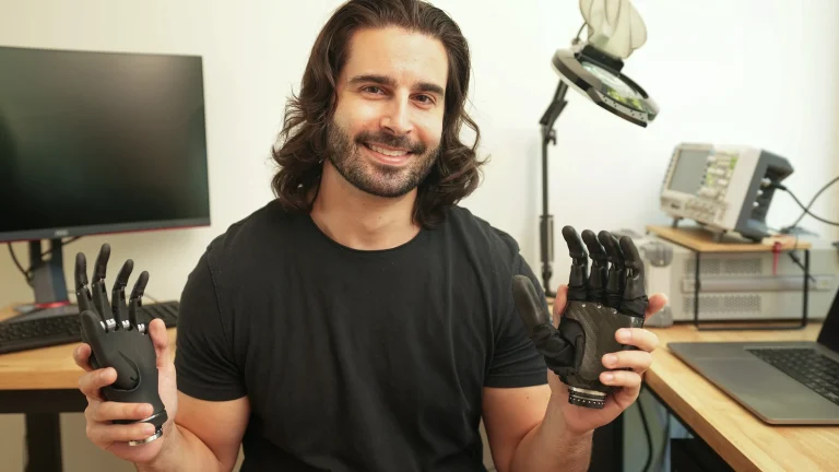 Imagine controlling a bionic limb with nothing more than a thought — no brain implants, no bulky equipment.